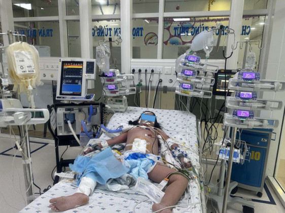 TP. HCM: Cứu sống một trường hợp trẻ sốc sốt xuất huyết, tổn thương ga, suy hô hấp nặng