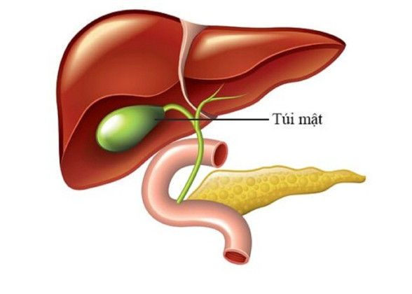 Những điều cần biết về bệnh Polyp túi mật