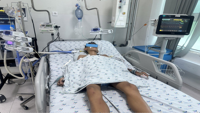 Cứu sống một trường hợp bệnh nhi ngạt nước nặng ở hồ bơi