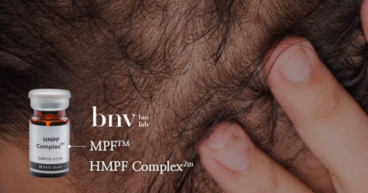 Công nghệ độc quyền trong điều trị rụng tóc hói đầu: Tương lai của điều trị tóc