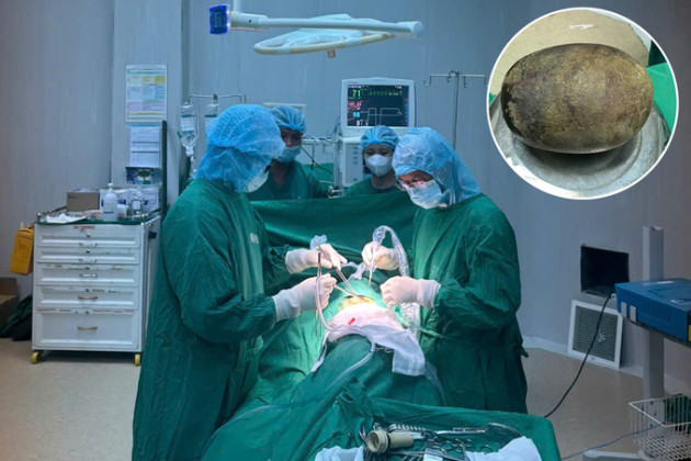 Đắk Lắk: Phẫu thuật lấy viên sỏi nặng 700g trong bàng quang cho nam bệnh nhân