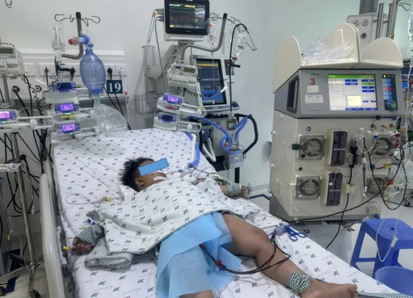 Cấp cứu bé trai nguy kịch vì sốc nhiễm trùng, tổn thương đa cơ quan