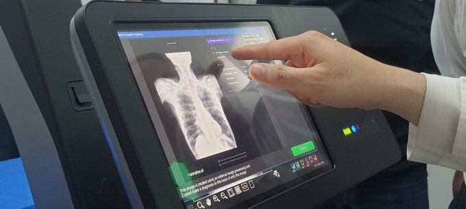 TP. HCM: Ứng dụng trí tuệ nhân tạo (AI) chẩn đoán bệnh tại xã đảo Thạnh An