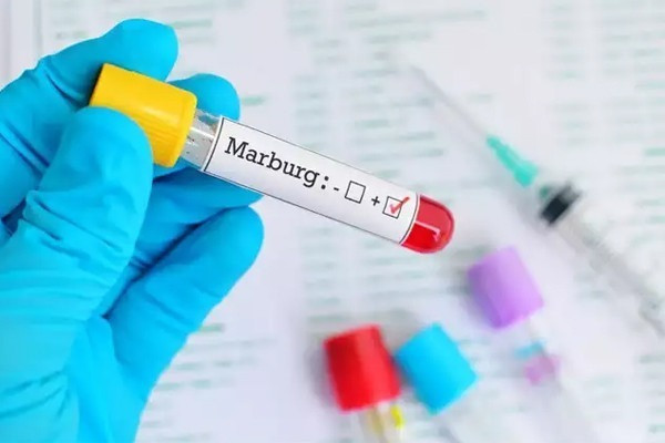 Long An tăng cường kiểm dịch y tế, năng lực xác định với bệnh Mác-bớc