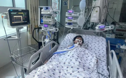 Can thiệp nội mạch cứu bé trai bị sốt xuất huyết kèm xuất huyết tiêu hóa