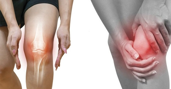 Bệnh thấp khớp và mùa lạnh cách phòng ngừa