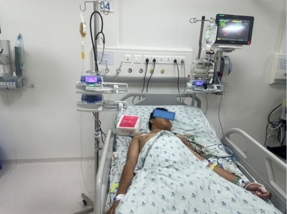 Cứu sống bệnh nhi sốt xuất huyết kèm thủng tá tràng