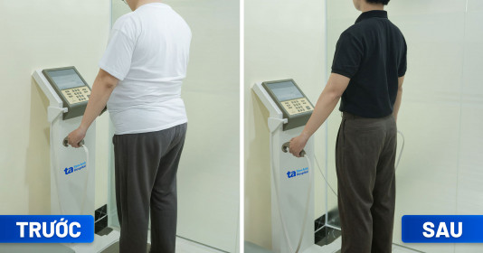 Thoát “bụng bia” nhờ trung tâm giảm cân chuẩn y khoa đầu tiên tại Việt Nam