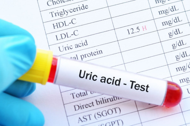 Việc làm mỗi ngày giúp ngăn axit uric cao, ngừa bệnh thận