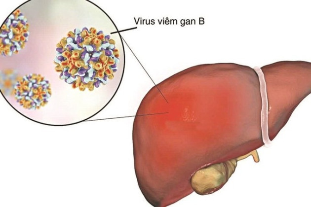 Phòng bệnh viêm gan B