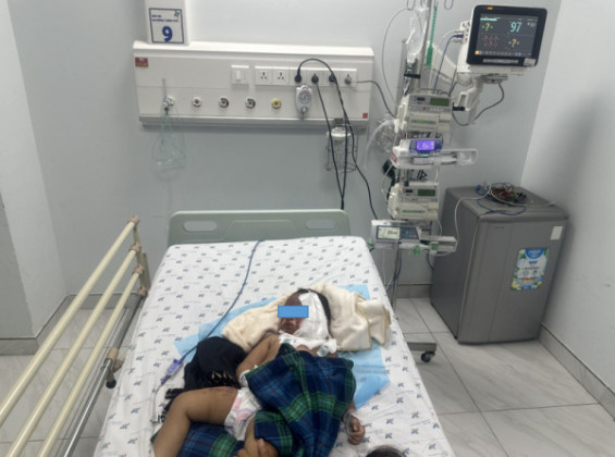 Cứu sống bé gái 16 tháng tuổi bị phỏng nặng do làm ngả bình nước sôi