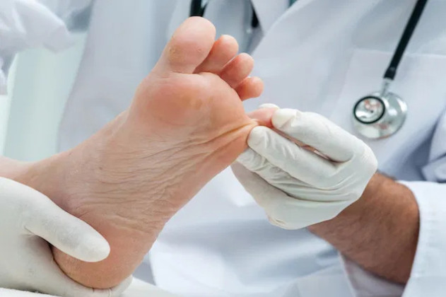 Triệu chứng và cách điều trị nấm chân