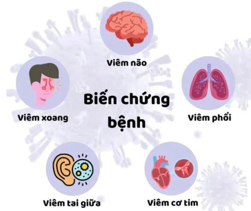 Các biến chứng của bệnh cúm