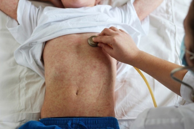 Họp trực tuyến về tăng cường phòng chống bệnh cúm và bệnh sởi
