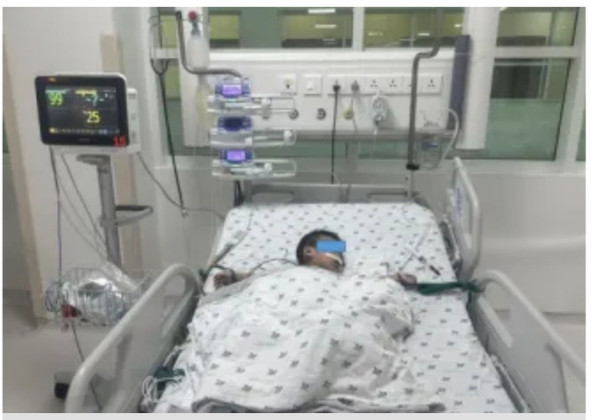 Cứu sống bệnh nhi 1 tuổi chấn thương vỡ khí quản hiếm gặp