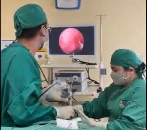 Bé trai 5 tuổi bị bi sắt súng đồ chơi bắn xuyên má, gãy xương mặt