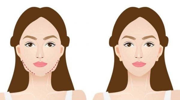 8 mẹo hiệu quả để giảm mỡ mặt