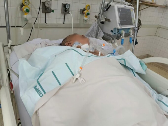 TP Hồ Chí Minh: Số ca bệnh biến chứng viêm não do zona thần kinh đang tăng dần