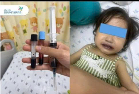 TP. Hồ Chí Minh: Cấp cứu kịp thời cứu sống một trẻ tím tái nặng do Methemoglobine máu