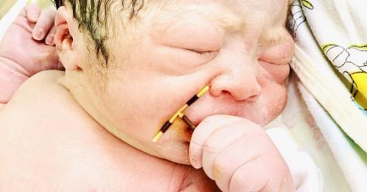 Rào cản cũng không thể ngăn con đến thế giới này - Bé trai chào đời tay cầm vòng tránh thai "gửi" trả bố mẹ