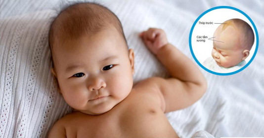 Hiện tượng "mở khóa đầu" ở trẻ sơ sinh? Nguy hiểm khôn lường khi tự chữa tại nhà
