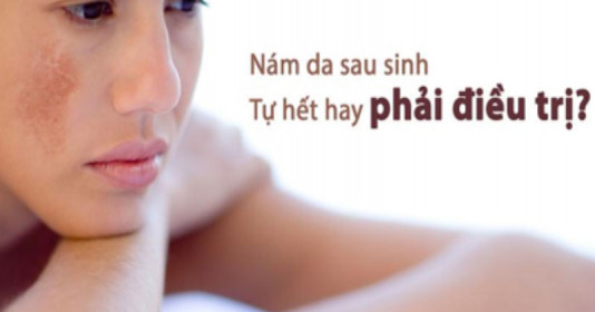 Đây là thời điểm trị nám sau sinh tốt nhất, mẹ đừng bỏ lỡ