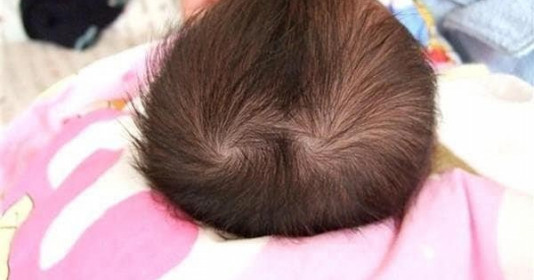 Trẻ có 2 xoáy tóc trên đầu thường có tính cách gì? Có thông minh như lời đồn không?