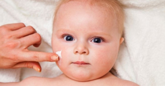 Mách mẹ cách điều trị tận gốc mụn trứng cá cho trẻ sơ sinh