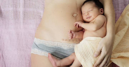 Những việc mẹ sinh mổ phải nhớ kẻo gây ra hậu quả khó lường