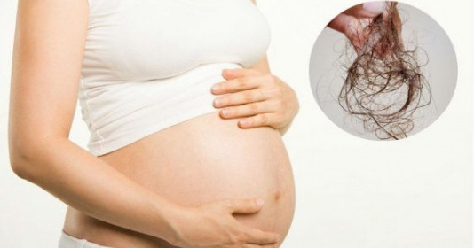 Rụng tóc sau sinh: Nguyên nhân và cách khắc phục cho mẹ bầu 