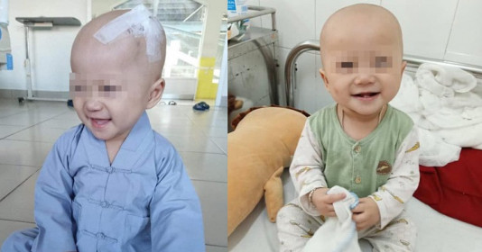 Em bé 14 tháng tuổi mang trong mình 2 loại υпɡ ᴛʜư vẫn luôn nở nụ cười tươi để chống lại bệnh tật