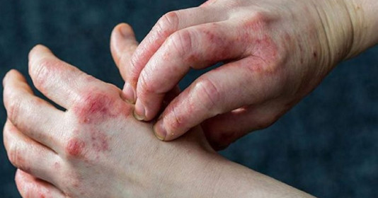Các nhà khoa học đã có tiến triển mới trong điều trị bệnh tiểu đường tuýp 1