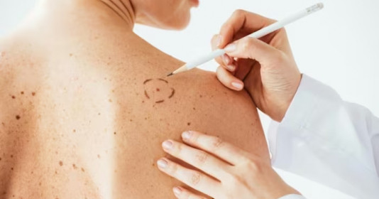 Kem chống nắng một lần nữa lại gây tranh cãi