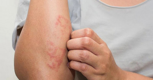 Bé trai ở Phú Thọ nhiễm sán máng sau khi nghịch cát