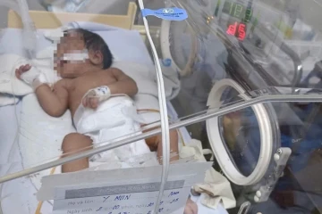 Bé sơ sinh 5 ngày tuổi suýt mất mạng vì mẹ cho ăn cơm