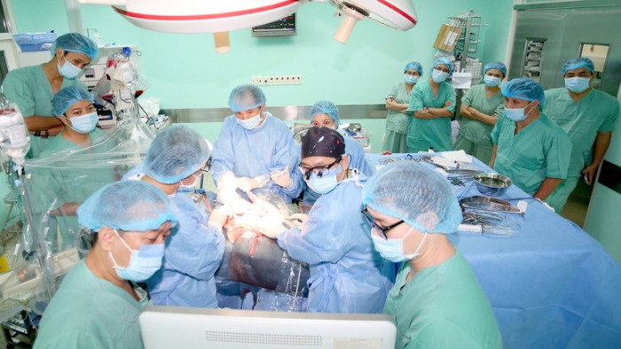 Bệnh viện Trung ương Huế làm chủ kỹ thuật ghép gan