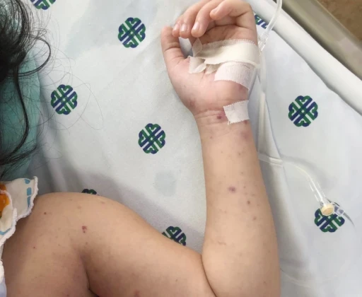 Cuối năm nhu cầu đi lại tăng cao, cảnh giác lây lan các dịch bệnh